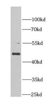 MDM2 Rabbit Polyclonal Antibody