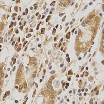 MDM2 Rabbit Polyclonal Antibody