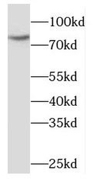 MDM4 Rabbit Polyclonal Antibody