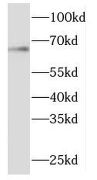 ME1 Antibody