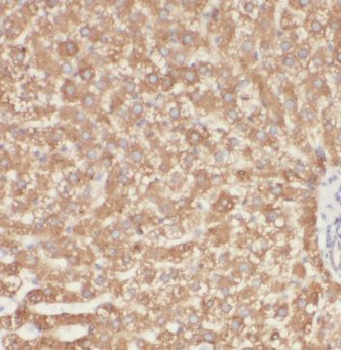 ME1 Antibody