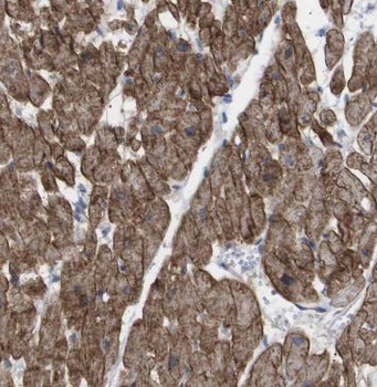 MECR Antibody