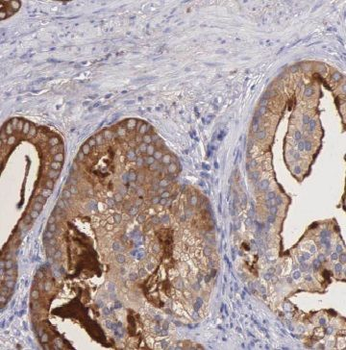 MED15 Antibody
