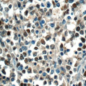 BORCS8 Antibody