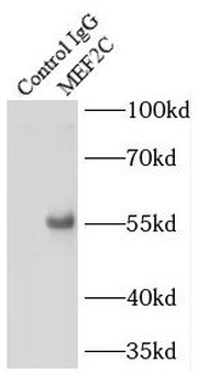 MEF2C Antibody