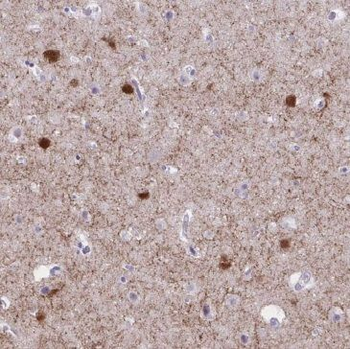 MEF2C Antibody