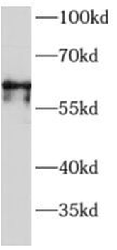 MEF2D Rabbit Polyclonal Antibody