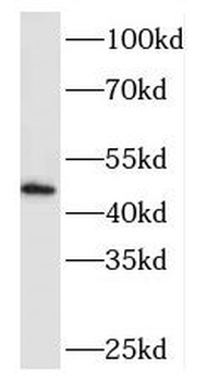 MEIS3 Rabbit Polyclonal Antibody