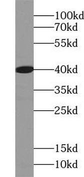 MAP2K1 Rabbit Polyclonal Antibody