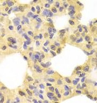MAP2K1 Rabbit Polyclonal Antibody