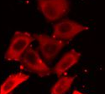 MAP2K5 Antibody