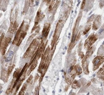 MAP2K5 Antibody