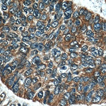 MLPH Antibody