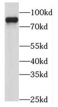 MEP1A Rabbit Polyclonal Antibody