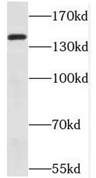 MET Rabbit Polyclonal Antibody