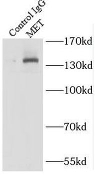 MET Rabbit Polyclonal Antibody
