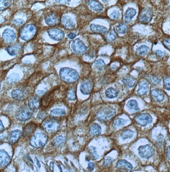 MET Rabbit Polyclonal Antibody