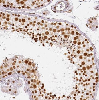 METAP2 Antibody