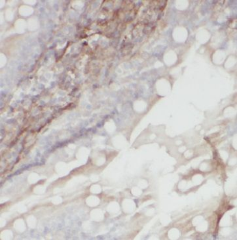 METTL16 Antibody