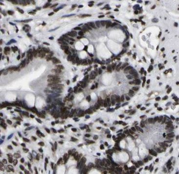 METTL9 Antibody