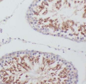 MEX3C Antibody
