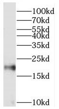 MFAP5 Rabbit Polyclonal Antibody