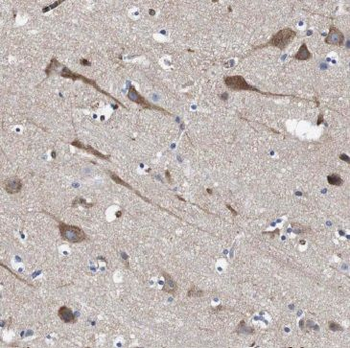 MFSD8 Antibody