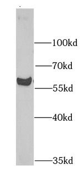 MGAT1 Antibody