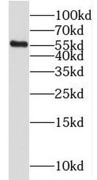 MGAT2 Rabbit Polyclonal Antibody
