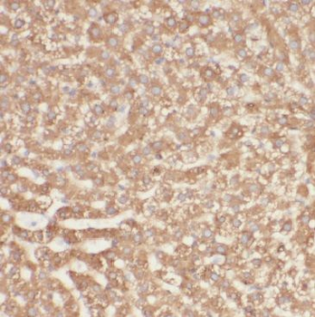 MGAT2 Rabbit Polyclonal Antibody
