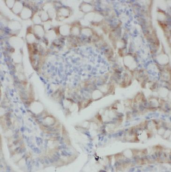 MGAT4A Antibody