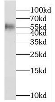 MGAT4C Rabbit Polyclonal Antibody