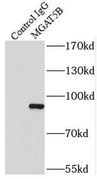 MGAT5B Antibody