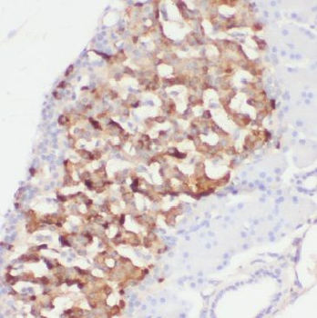 OGA Antibody
