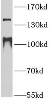 GRM1 Rabbit Polyclonal Antibody