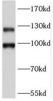 GRM2 Antibody