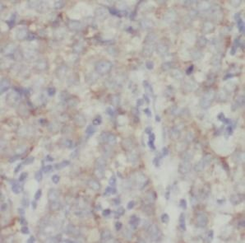MGP Antibody