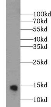 MGP Mouse Monoclonal Antibody