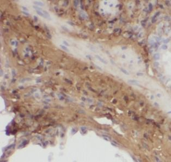 MGP Mouse Monoclonal Antibody
