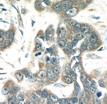 MIA Rabbit Polyclonal Antibody