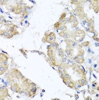 MICA Antibody