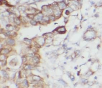 MICB Antibody
