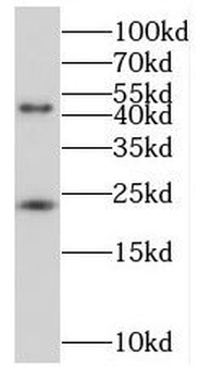 MID1IP1 Antibody