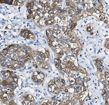 MDK Rabbit Polyclonal Antibody