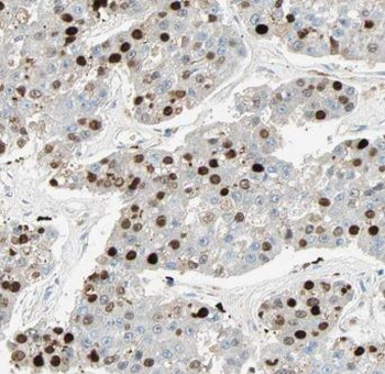 MIER1 Rabbit Polyclonal Antibody
