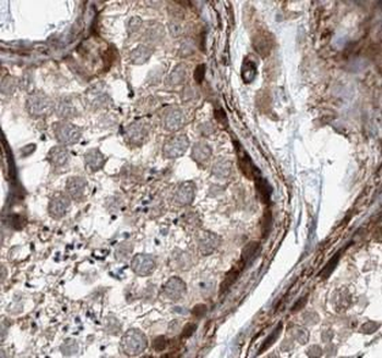 MIF Antibody