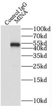 RIOX2 Antibody