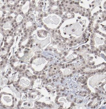 RIOX2 Antibody