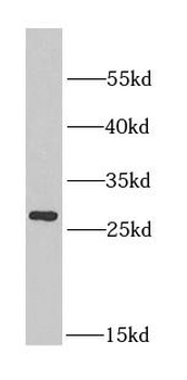 MIP Antibody