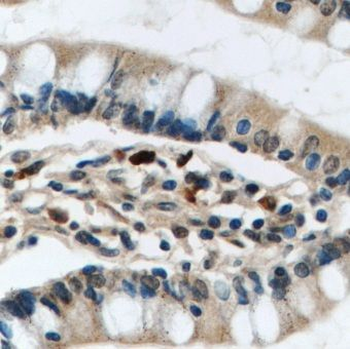 MRTFA Antibody